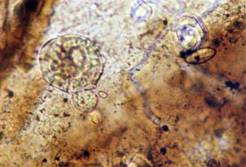 Ceratiocaris papilio microscopic structures